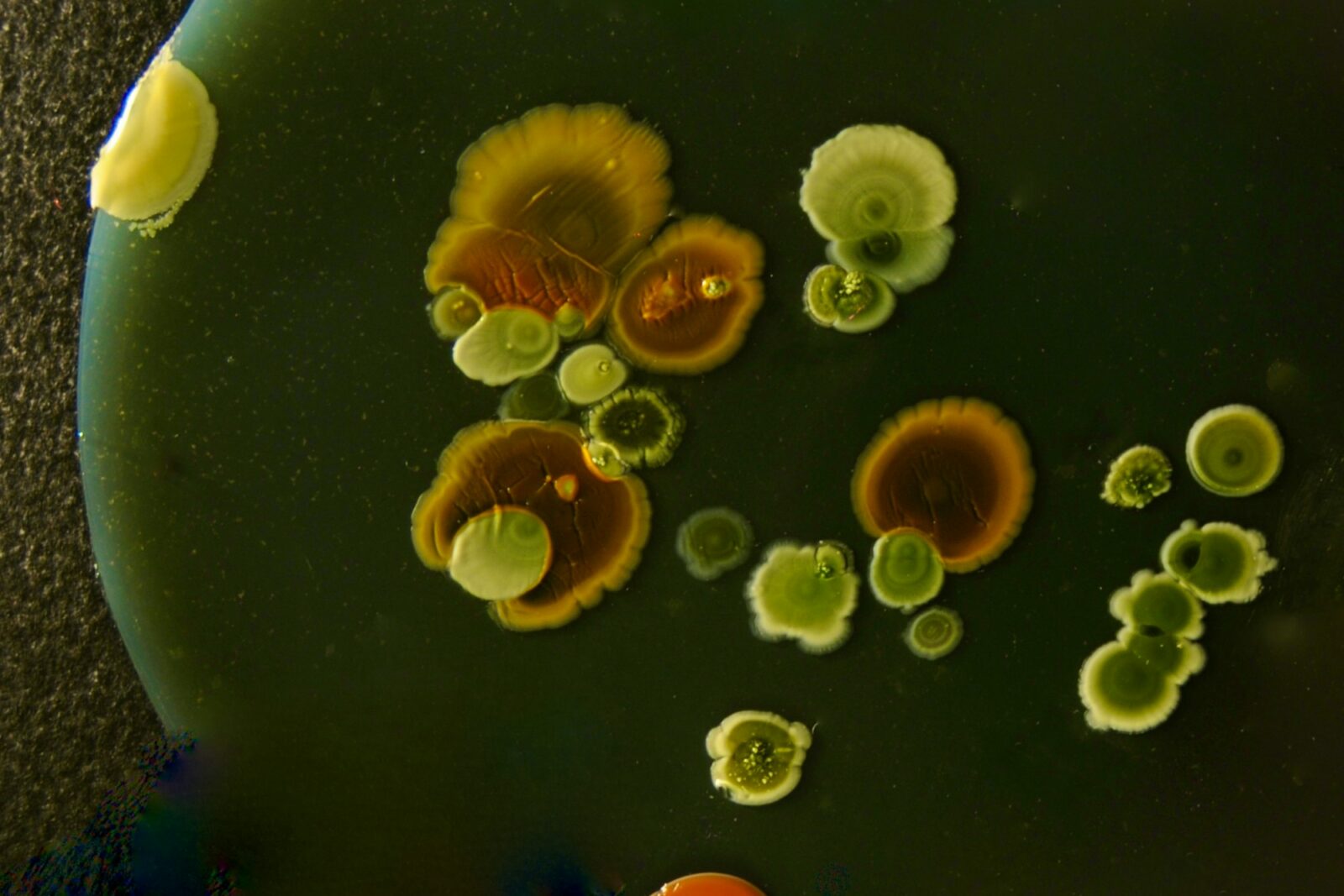 New ‘Metal Eating Bacteria’; Discovered By BHU Scientists Colourful bacterial colonies growing on a dark surface
