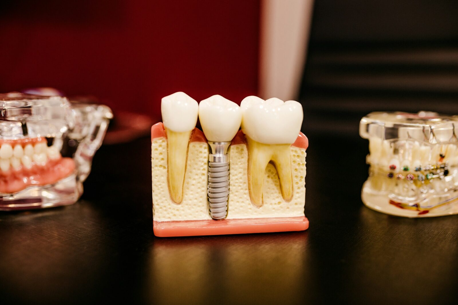 Why Dental Science has become a popular course? A dental teaching model showing a row of teeth set in a jaw